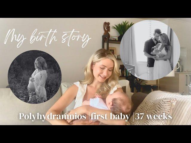 My Birth Story | Positive Birth at 37 Weeks | Polyhydramnios | Vacuum Assisted