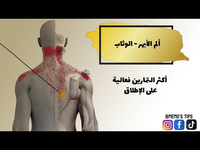 الوتاب - الأبهر - ديق الصدر وألم القفص الصدري كاملا مع ألم الرقبة او اسفل الرأس او حتى لوحين الكتف