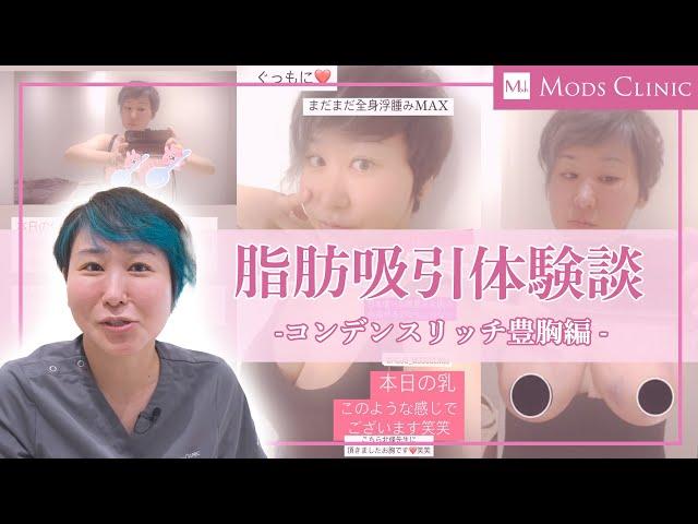 脂肪吸引体験記 -コンデンスリッチ豊胸 編-／立山彩子 医師｜Mods Clinic（モッズクリニック）