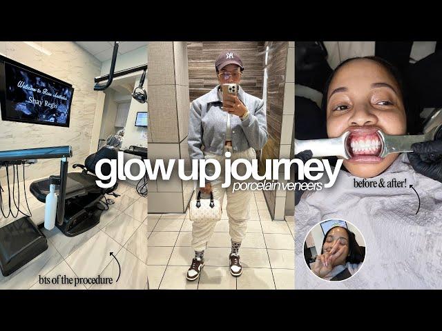 GLOW UP JOURNEY: Fixing My Teeth Part 1 (Invisalign + Porcelain Veneers)