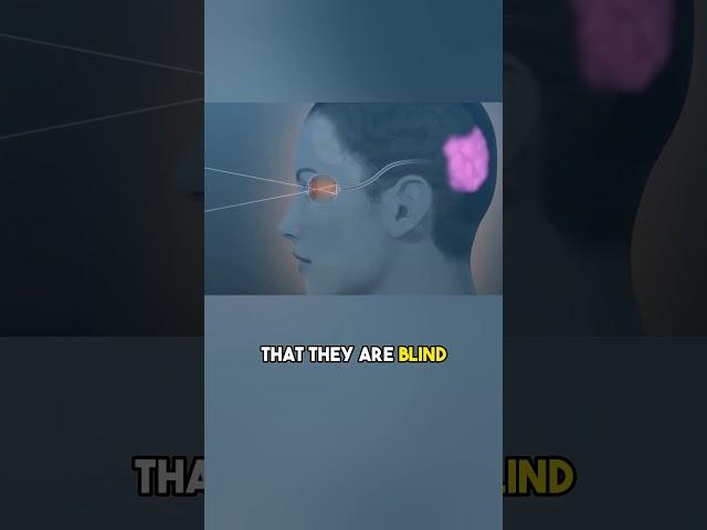 One Of the Most Mind-Boggling Syndromes There is - Anton Syndrome