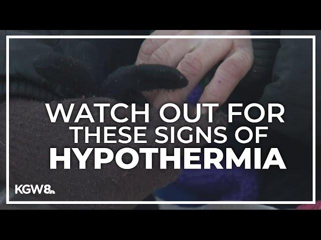 With temperatures dropping, here are the warning signs of hypothermia