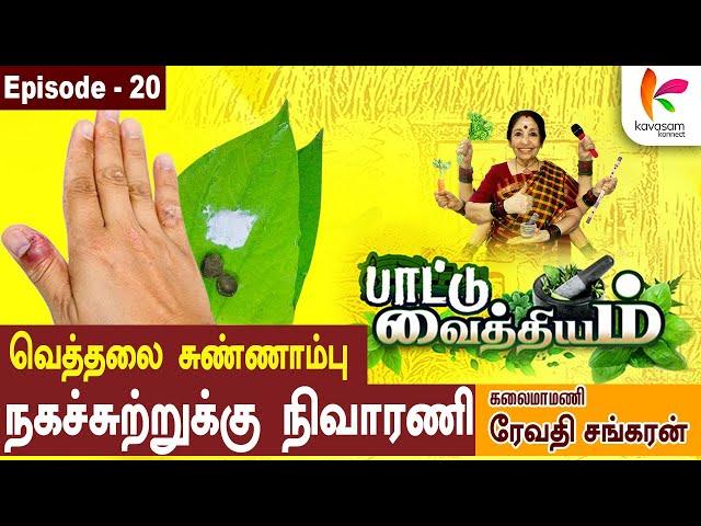 சுத்தி சுத்தி வலிச்சீங்க... l நகச்சுற்று l Paattu Vaithiyam 20  l Revathi Sankaran  l #episode20