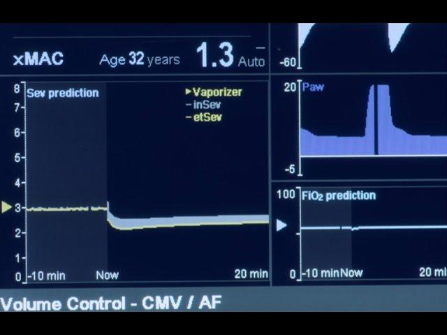 Dräger Perseus® A500 - Smart Features Part 1: Vaporview