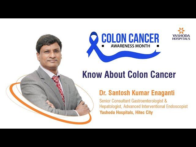 Know About Colon Cancer | Yashoda Hospitals Hyderabad