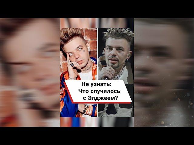 Не узнать: Что случилось с Элджеем?  #shorts