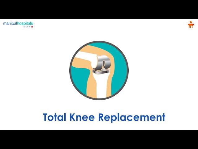 What is Total Knee Replacement? l Manipal Hospitals Bengaluru