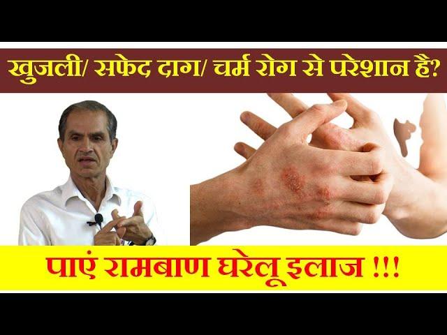 आप किसी भी तरह के चर्म रोग से पीड़ित है ?? पाएं रामबाण इलाज !! How to treat skin diseases naturally.