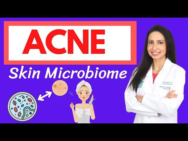 ACNE and the Skin Microbiome:  A Holistic Approach to Healing Your Acne from the Inside Out