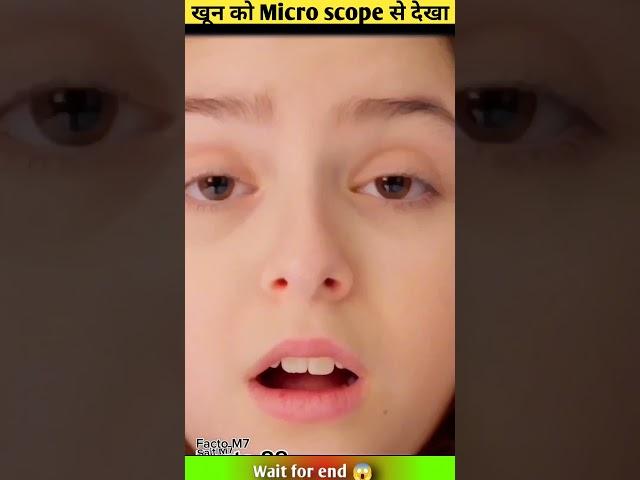 खून को Micro scope से देखा  ~mini wood toy / @MicroMasterr  @theSachinfacts852  #shorts