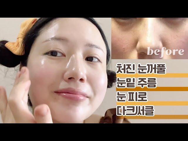 CC) 탄력있는 눈꺼풀, 눈밑, 미간, 전택궁, 눈가 마사지,  eyelid & under eyes massage