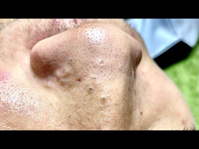 Satisfying video with Chung Vo Spa | 339