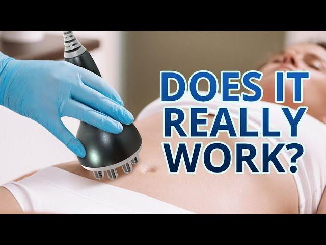 Ultrasonic Cavitation| Weight Loss Transformation  | Does it Really Work?!?  | MYCHWAY