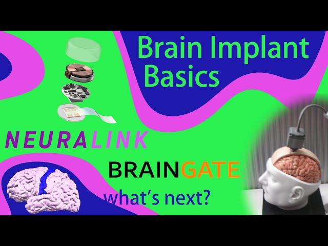 What Can You Do With a Brain Implant? Neuralink, BrainGate, and the Future