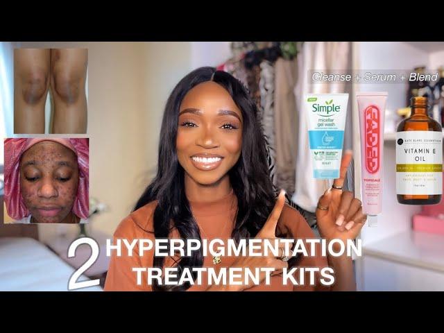 How to Fade Hyperpigmentation Quickly | Face and Body Treatment Kits + Routine Recommendation