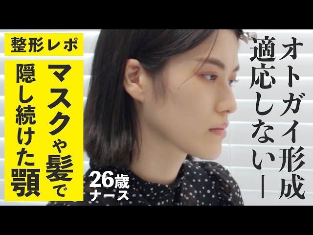 【 整形密着 】 面長で大きなアゴに悩んでいたのにドクターは"小顔"だと言う【前編】