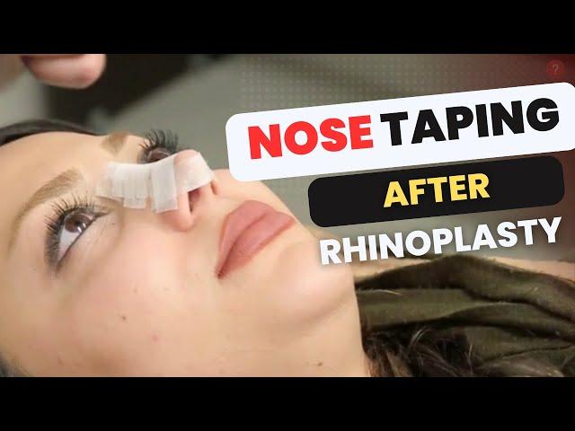 How to tape the nose after Rhinoplasty | AvaMedi 2024