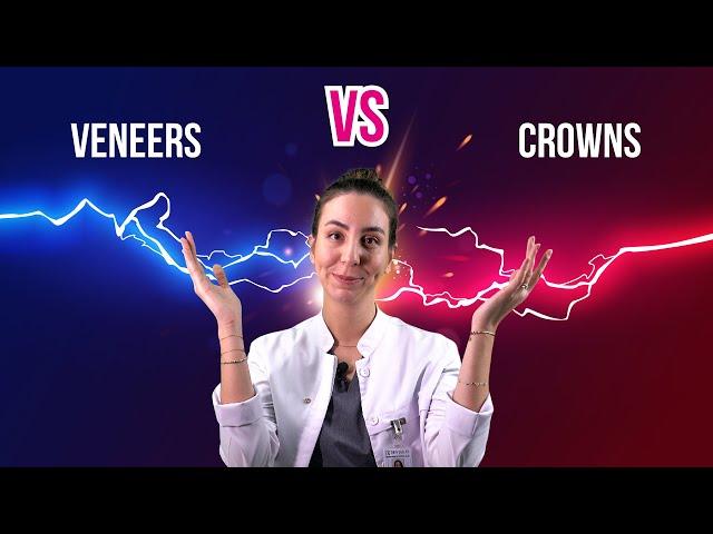 Veneers vs crowns - What is the difference?