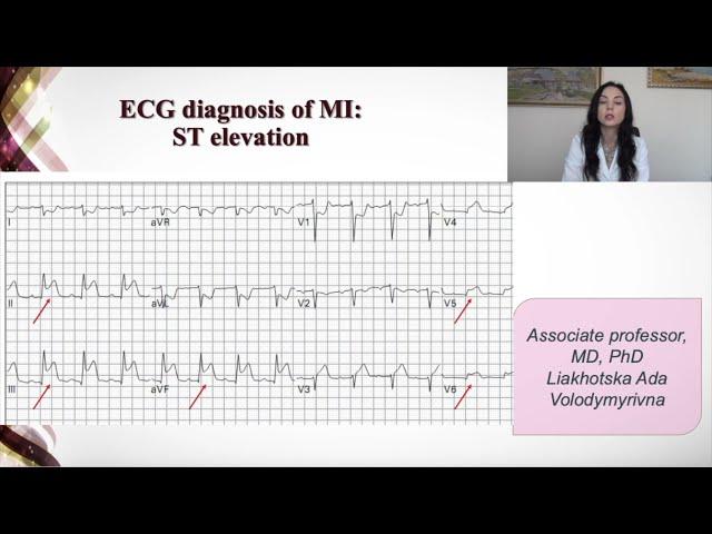 Basic symptoms and syndromes of coronary heart disease