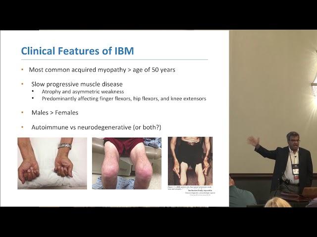 Clinical features and progression of IBM, Tahseen Mozaffar, MD