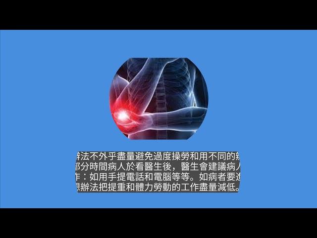 張民冠醫生解說:網球肘（肱骨外上髁炎）