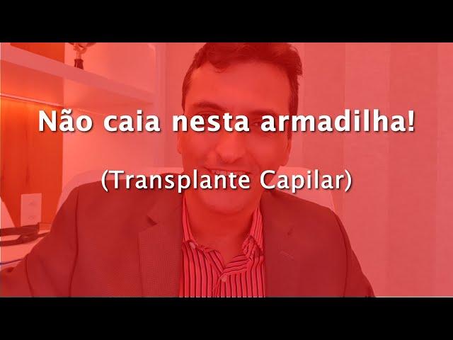 Não caia nesta Armadilha! [Transplante Capilar]