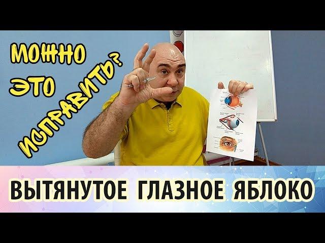 Исправление близорукости: как быть с вытянутым глазным яблоком