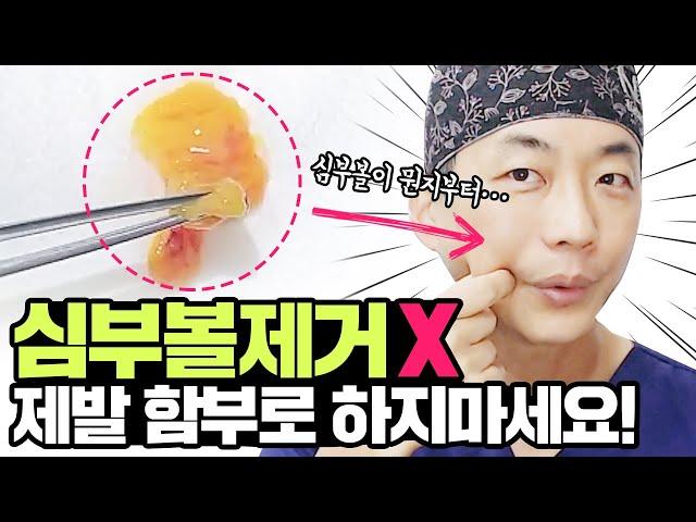 심부볼제거 입안절개 말리는 이유 |심부볼 함부로 제거 금지도대체 심부볼이 뭔데? #심부볼 완전분석/How to get rid of deep cheeks