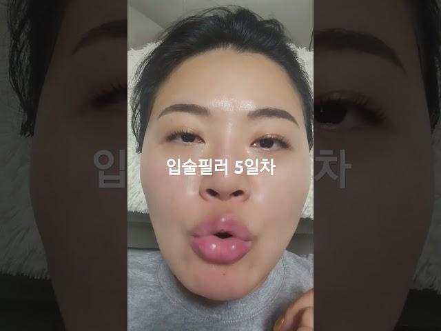 입술필러 5일차           #내돈내산후기 #입술필러 #메이크업