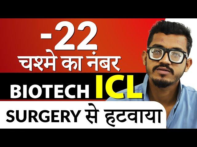 -22 चश्मे का नंबर ICL Surgery से हटवाया। Biotech ICL Lens for Correcting Specs Power more than -18 D