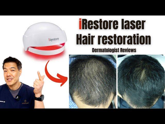 iRestore laser hair restoration| Dermatologist Reviews