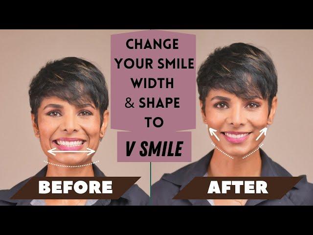 How to CHANGE Your SMILE Width and Shape to V SMILE