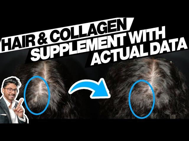 Best Collagen Drink Ever Made? Before + After, Scientific Data Analysis