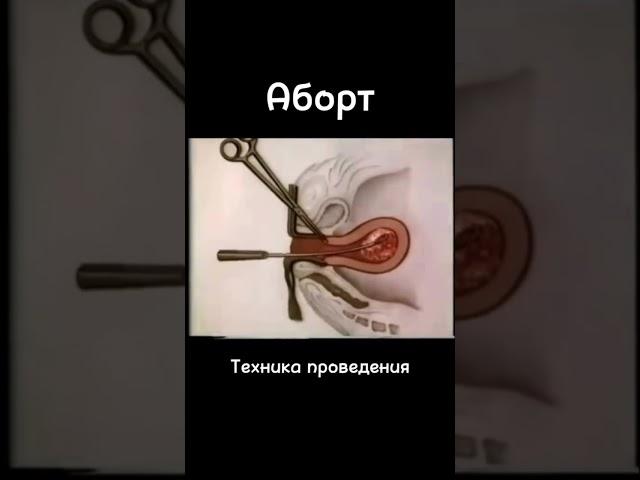 #акушергинеколог #акушерство #женскоездоровье
