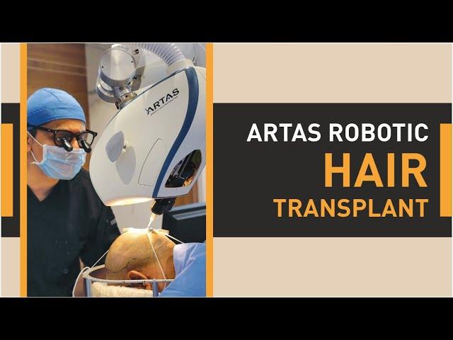 Hair Transplant in Ahmedabad || Best Clinic & Cost for Hair Transplant in Ahmedabad