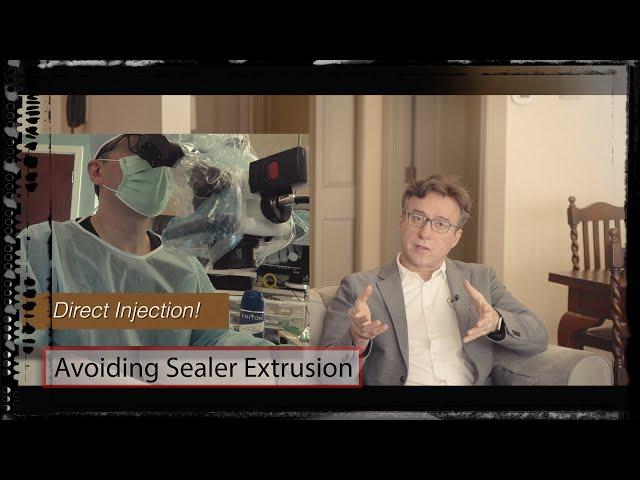 Prevention of Sealer Extrusion during obturation