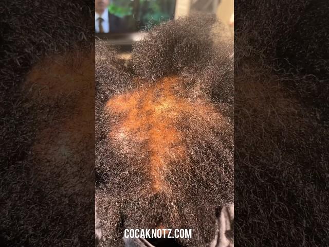 Hairloss treatment 🪄 cocaknotz.com #naturalhair #youtubeshorts #shorts