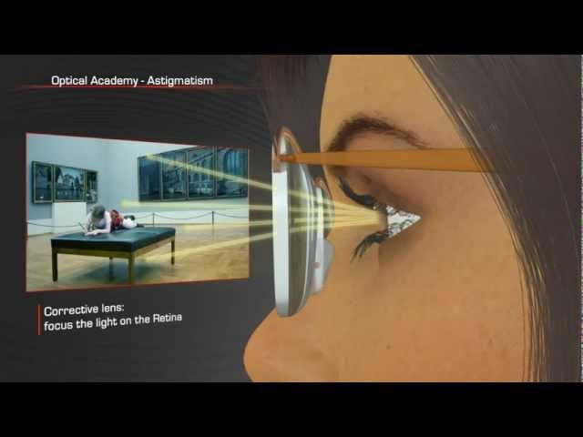 Shamir Optical Academy Astigmatism