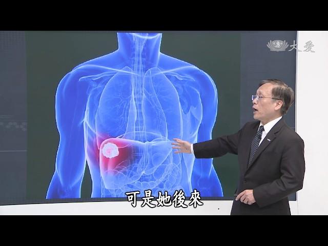 【大愛醫生館】20190222 - 吹皺一池春水~肝臟囊腫