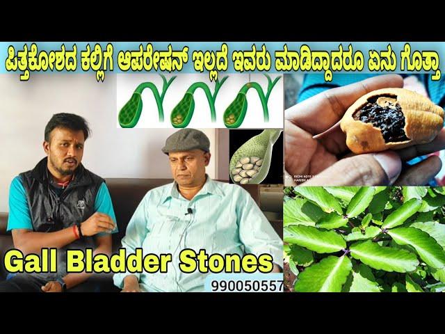 ಪಿತ್ತಕೋಶದ ಕಲ್ಲು Gall Bladder stone ಸಮಸ್ಯೆಗೆ ಇಲ್ಲಿದೆ ಪರಿಹಾರ Phone 9900505573 Ayurveda tips in Kannada