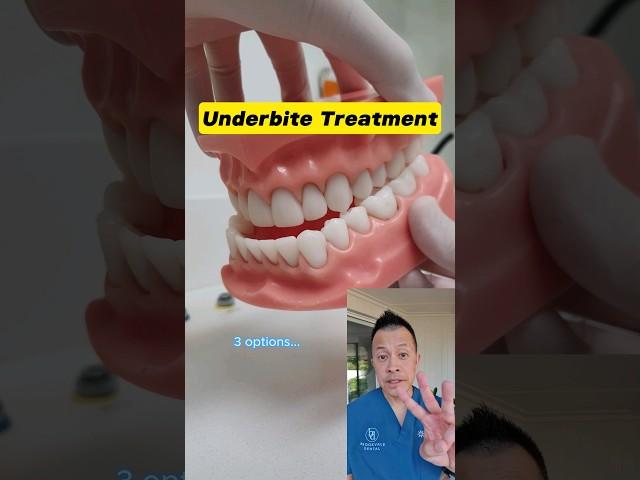 Transform Your Smile: 3 Underbite Correction Options You Need to Know! #shorts #dentallan