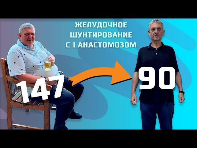 СБРОСИЛ 57 КИЛОГРАММ! Желудочное Шунтирование - Интервью с пациентом