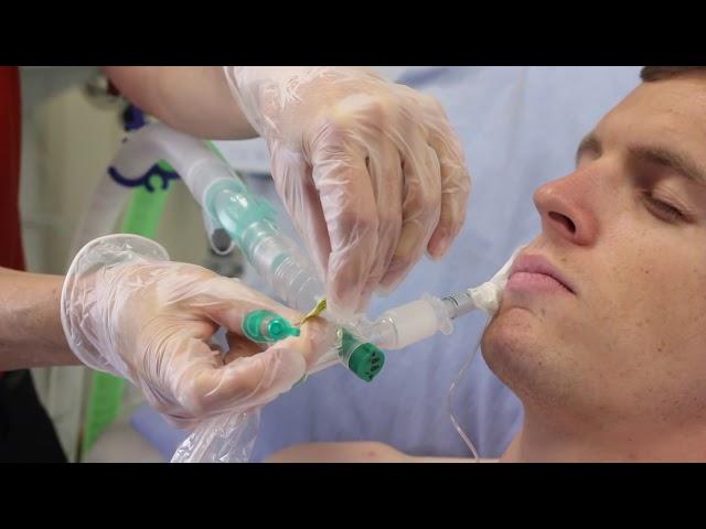 Using Intersurgical's TrachSeal™ closed suction systems