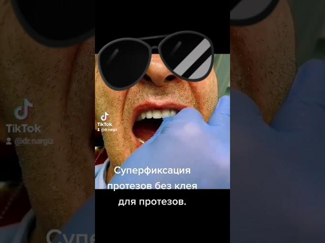 Съемные протезы зубов. Суперфиксация съемного протеза без клея для протезов.