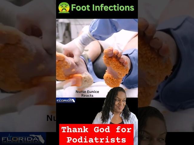  Foot Infections & Toe Jam | Nurse Eunice Reacts #FootFungus #AthletesFoot