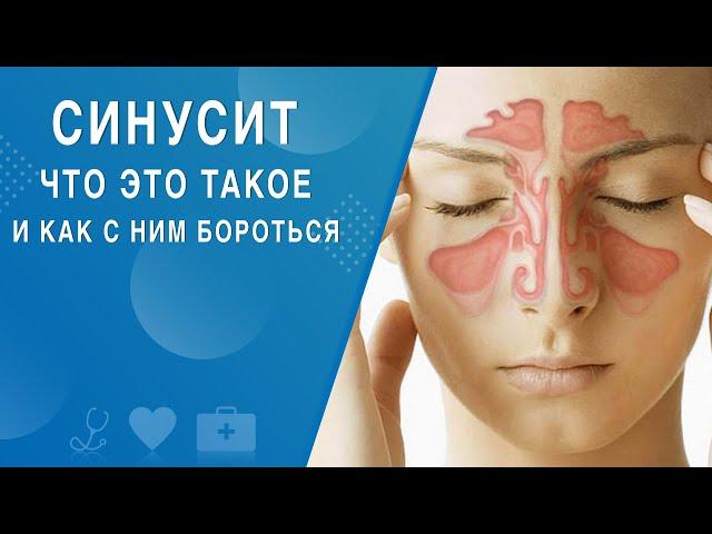 Синусит. Что это такое и как с ним бороться. На здоровье 08.05.2021