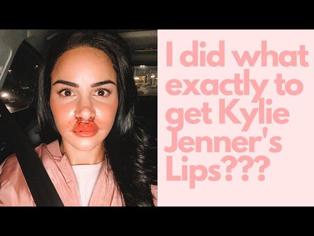 I DID WHAT TO GET KYLIE JENNER'S LIPS????