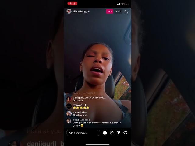 Dime baby shows her black eye and says Baltimore Bella is ducking smoke? 