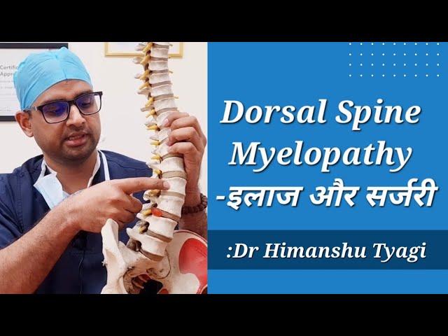 Dorsal Spine Myelopathy क्या होती है ?(इलाज और सर्जरी). Compressive dorsal Myelopathy.