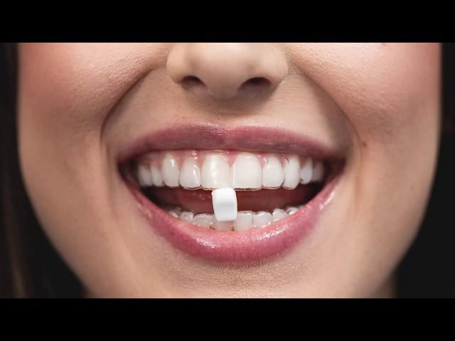 Movemints are the Fresh Mints for Your Invisalign!